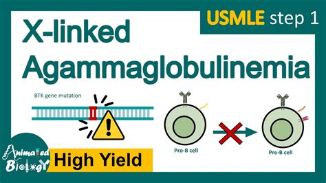 agammaglobulinemia x linked.